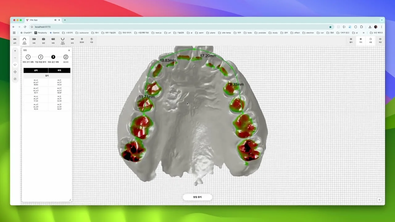 Webceph - 치아교정 및 양악수술을 위한 3D 치아 분석 툴 개발